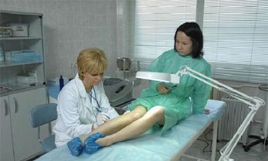 πώς να αντιμετωπίσετε τους κιρσούς στα πόδια